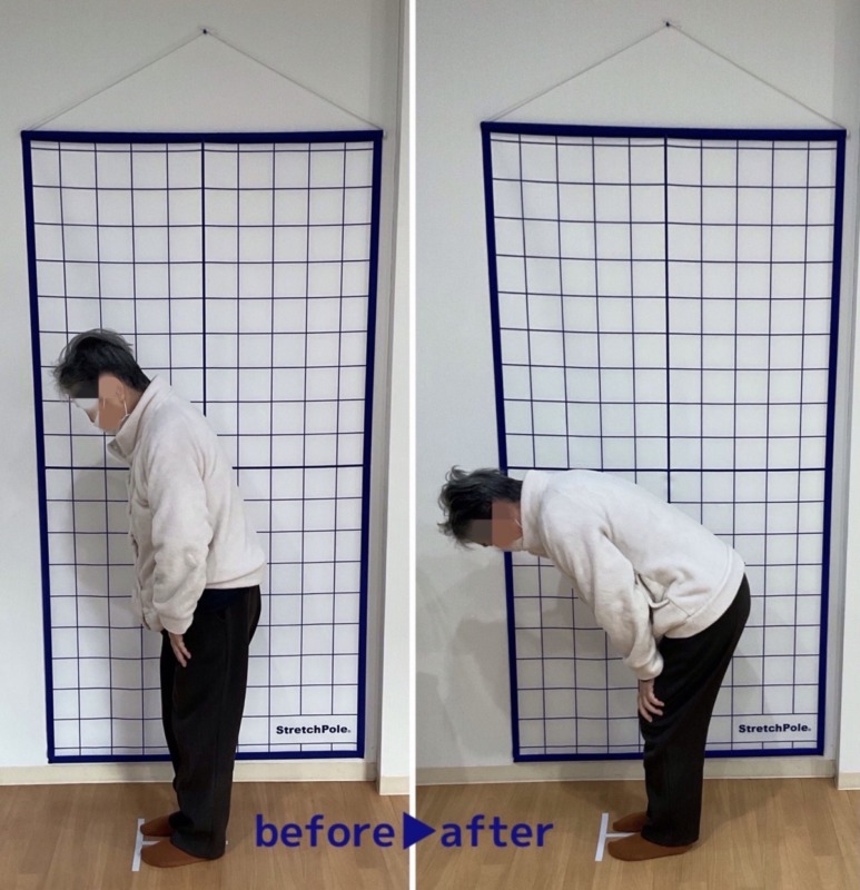 五所川原市　ぎっくり腰でお悩みの患者様