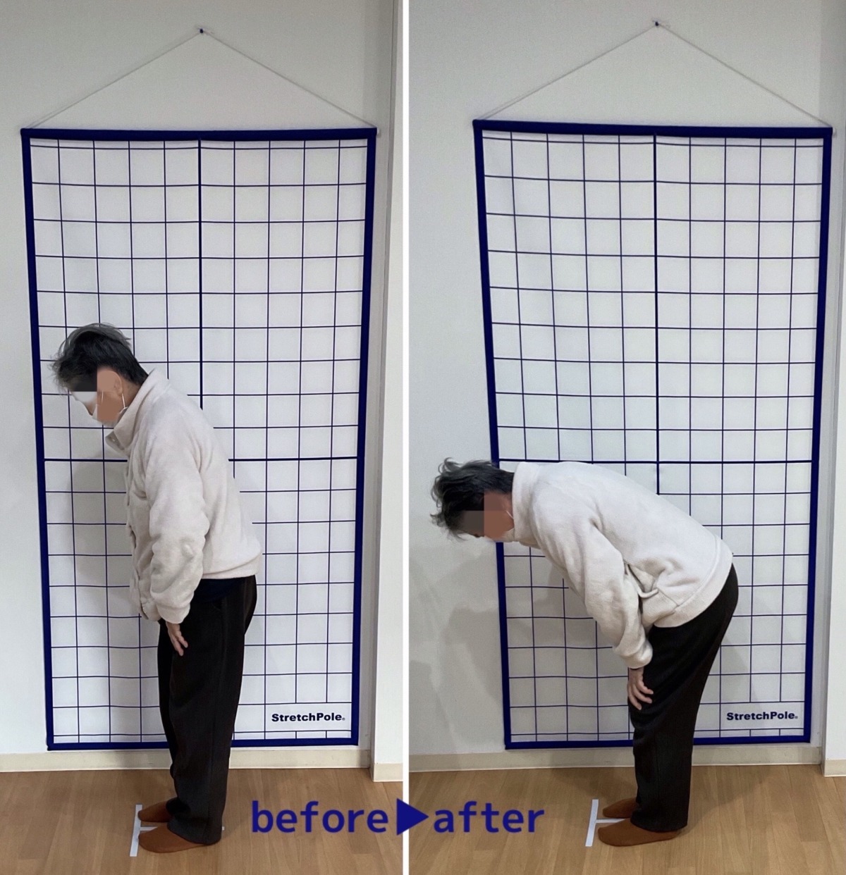 五所川原市　ぎっくり腰でお悩みの患者様